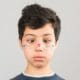 Descubre las diferencias entre la cirugía y la terapia visual para estrabismo. Conoce cuál es más adecuada para ti en Opticalia Zaben.